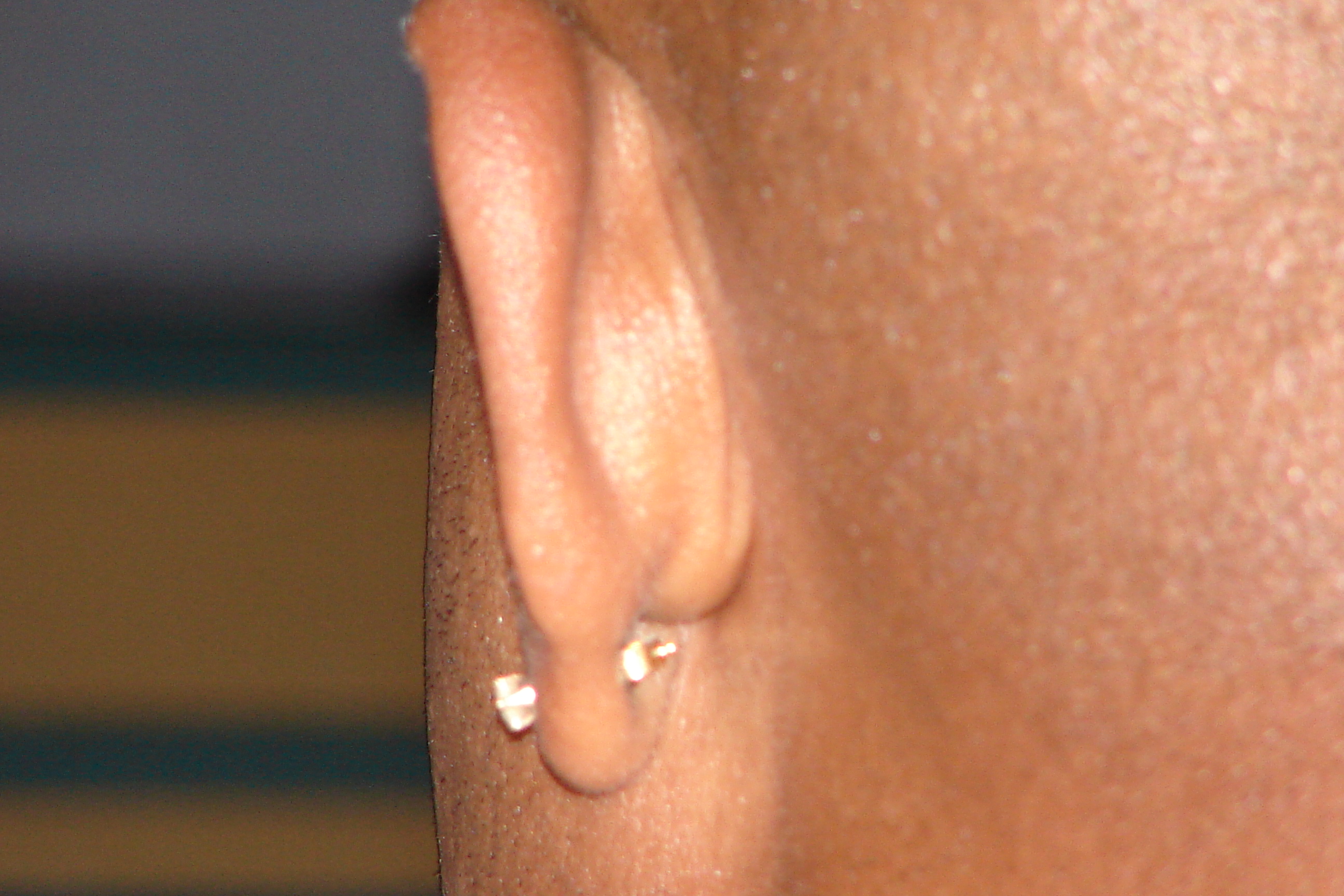 Virgils Ear